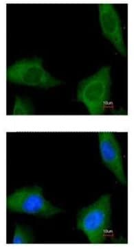 Anti-COASY antibody(AB227272)