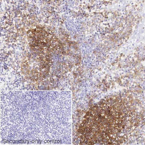 Anti-CD19 antibody [EPR5906](AB134114)