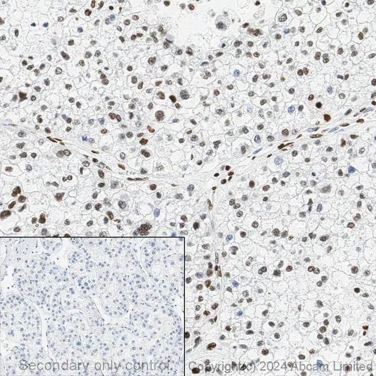 Anti-Histone H3 (acetyl K27) antibody [EP16602] - ChIP Grade(AB177178)