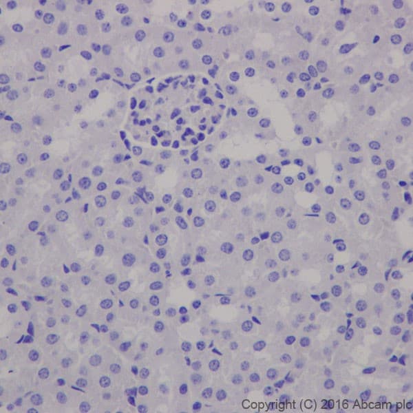 Anti-EAAT2 antibody [EPR19794](AB205247)