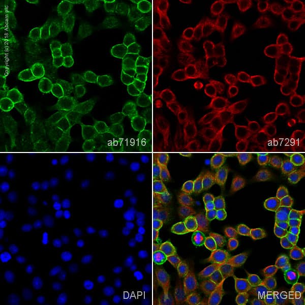 Anti-EpCAM antibody(AB71916)
