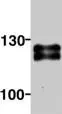 Ctip2 Antibody 25b6 Ab18465 Western Blot Img29208
