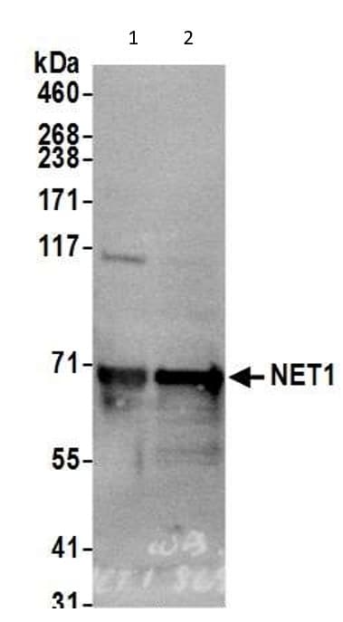 Net1 Antibody Ab113202  Western Blot Img185085