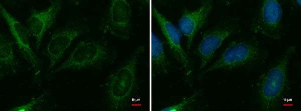 Cer1 Antibody Ab184133  Immunocytochemistry Immunofluorescence Img119226