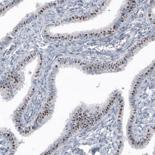 Anti-FoxJ1 antibody [CL3989](AB220028)