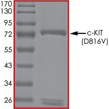 Recombinant human c-Kit (mutated D816V) protein(ab268415)