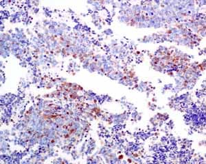 Scgn Secretagogin Antibody Epr7477 Bsa And Azide Free Ab248768  Immunohistochemistry Formalin Pfa Fixed Paraffin Embedded Sections Img122696