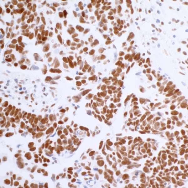 Anti-BRD4 antibody [BL-151-6F11] - BSA free(AB314054)