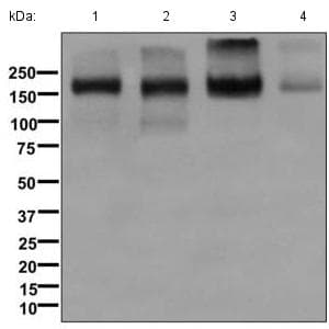 Anti-P Glycoprotein antibody [EPR10364-57](AB170904)