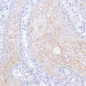 Anti-TROP2 antibody [SP293] - BSA and Azide free(AB272014)