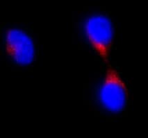 Anti-M6PR (cation independent) antibody [2G11](AB2733)