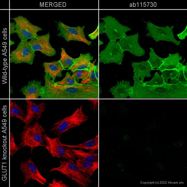 Anti-Glucose Transporter GLUT1 antibody [EPR3915] - BSA and Azide free(AB252403)
