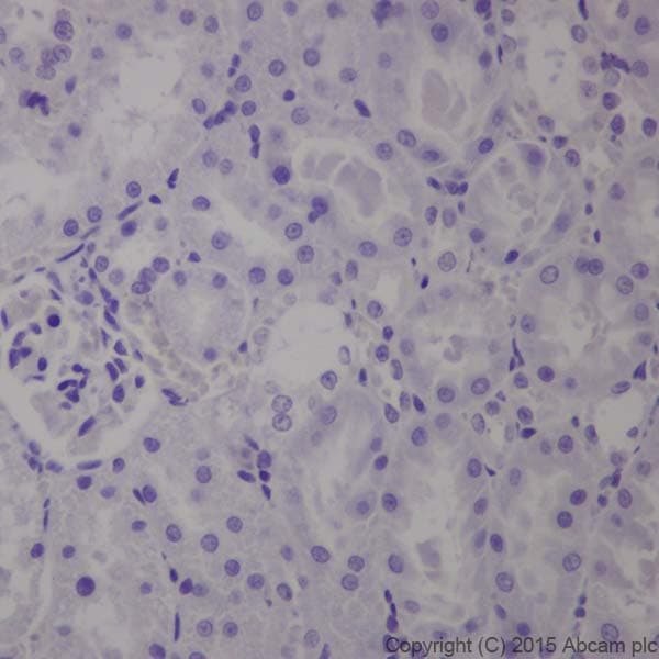 Anti-GAD65 + GAD67 antibody [EPR19366](AB183999)