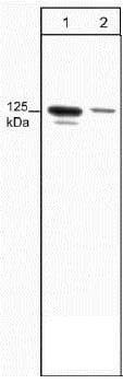 Fak Phospho Y397 Antibody M121 Ab24781  Western Blot Img107062