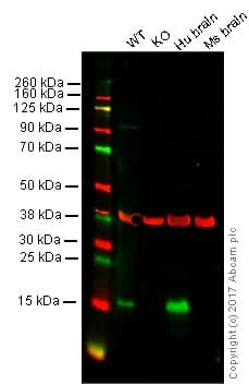 Anti-Alpha-synuclein antibody [MJFR1](AB138501)