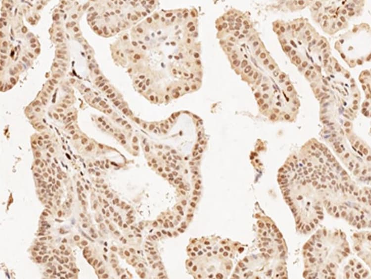 Anti-MASH1/Achaete-scute homolog 1 antibody(AB235198)