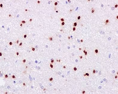 Anti-SOX2 antibody [EPR3131](AB92494)