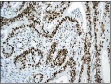 Anti-MSH6 antibody [EPR3945](AB92471)