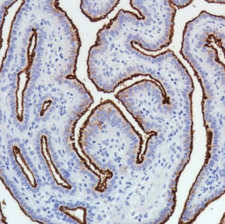 Anti-SLC34A2 antibody [SP322] - N-terminal(AB228474)