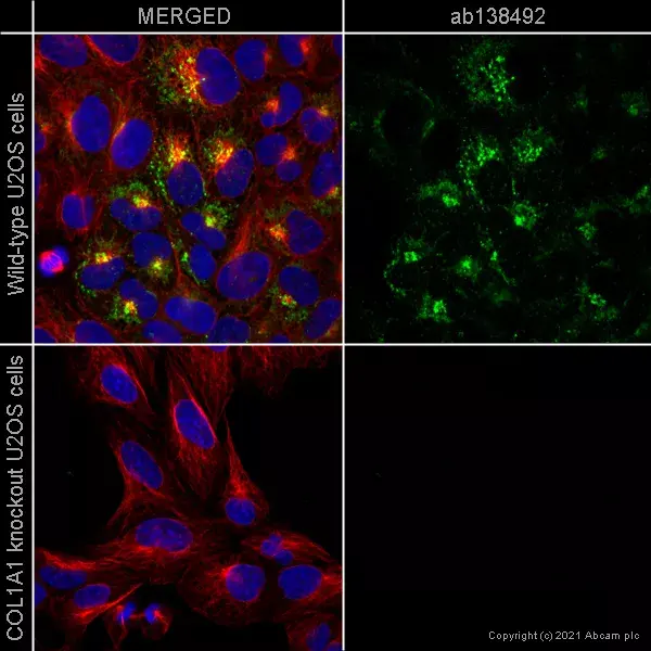 Anti-Collagen I antibody [EPR7785](AB138492)