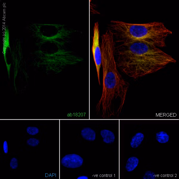 Beta Iii Tubulin Antibody Neuronal Marker Ab18207 Immunocytochemistry Immunofluorescence Img17372