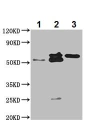 Prune Antibody Ab237518  Immunoprecipitation Img1561