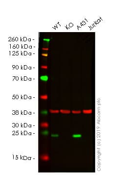 Anti-IL-18 antibody [EPR19954-188](AB243091)