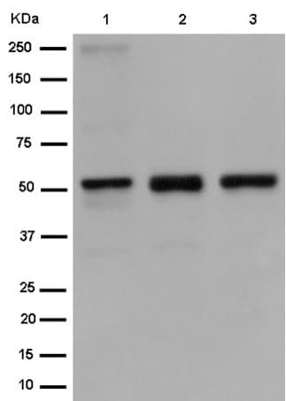 Anti-Retinoic Acid Receptor gamma antibody [EPR2020(N)] - N-terminal(AB187159)