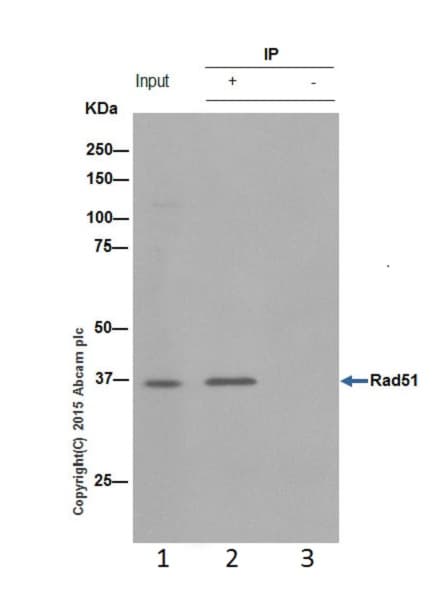 Anti-Rad51 antibody [EPR4030(3)](AB133534)