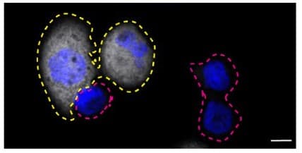 Syk Antibody Ep573y Ab40781  Immunocytochemistry Immunofluorescence Img430405