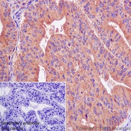 Actr1b Antibody Epr16969 Bsa And Azide Free Ab251406  Immunohistochemistry Formalin Pfa Fixed Paraffin Embedded Sections Img115458