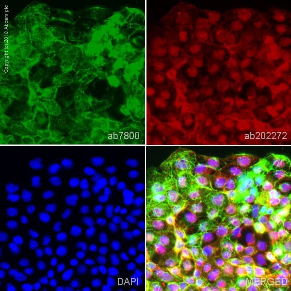 Anti-Cytokeratin 14 antibody [LL002](ab7800)