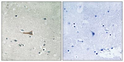 Cd167a Ddr1 Phospho Y513 Antibody Ab193550  Immunohistochemistry Formalin Pfa Fixed Paraffin Embedded Sections Img61501