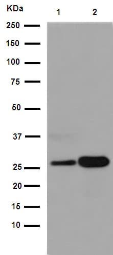 Anti-C1QA antibody [EPR14634](AB189922)
