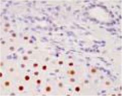 Anti-HNF-4-alpha antibody [K9218](ab41898)