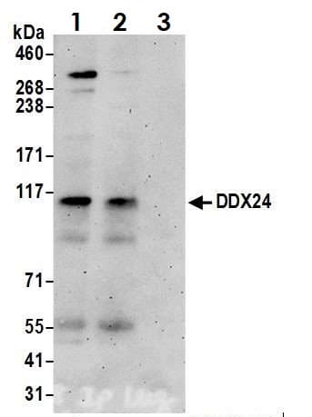 Anti-DDX24 antibody(ab70463)