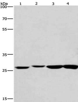 Klf7 Antibody Ab197690  Western Blot Img111495