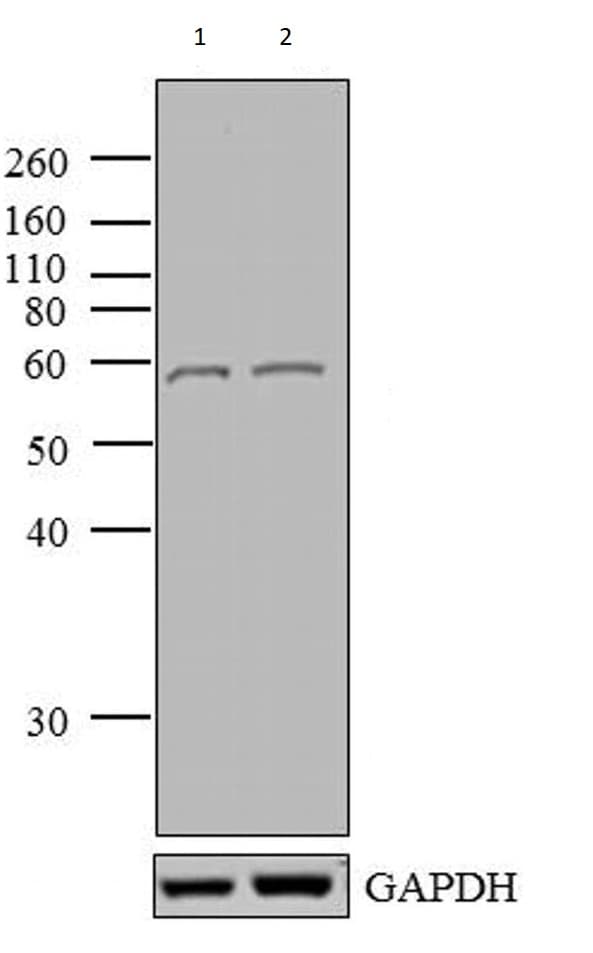 Anti-DR5 antibody(AB16329)