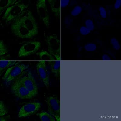 Anti-DNA/RNA Damage antibody [15A3](AB62623)