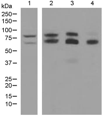 Anti-ADAM10 antibody [EPR5622](AB124695)
