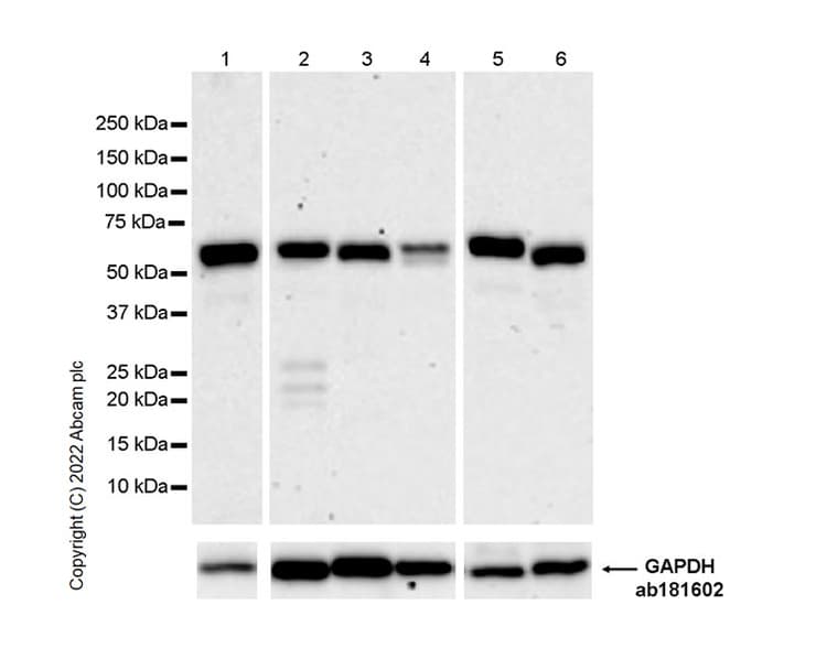 Anti-UBR7 antibody [EPR26170-67]