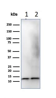 Beta 2 Microglobulin Antibody B2m 1118 Bsa And Azide Free Ab212752  Western Blot Img32742