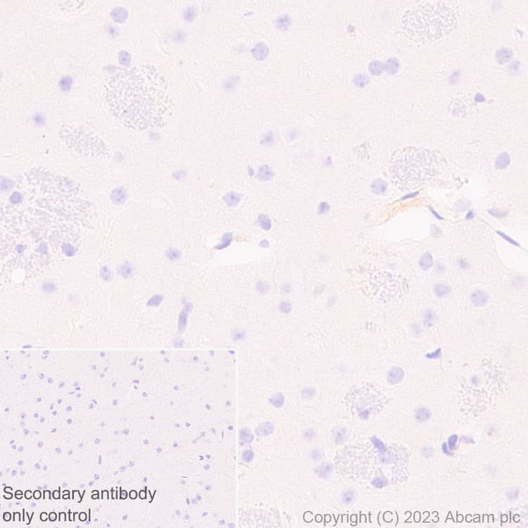 Anti-Apolipoprotein B-100 antibody [EPR19946-175](AB315265)