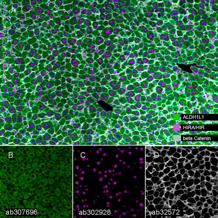 Anti-beta Catenin antibody [E247] - ChIP Grade(AB32572)