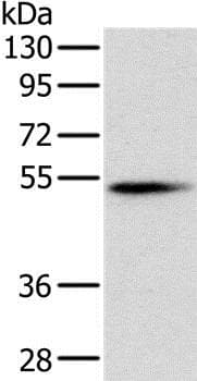 Anti-Pancreatic Lipase/PTL antibody(AB198181)