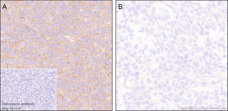 Cd47 Antibody Epr24922 5 Ab300435  Immunohistochemistry Formalin Pfa Fixed Paraffin Embedded Sections Img400682