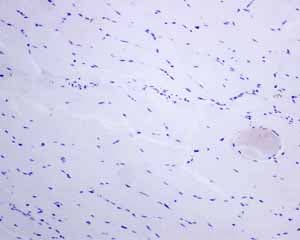 Anti-Syndecan-1 antibody [EPR6454](AB128936)