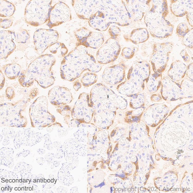 Anti-IL-6R antibody [EPR24322-143](AB271042)