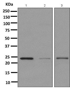 Anti-TMS1/ASC antibody [EPR10402(B)] - BSA and Azide free(AB249023)