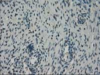 Anti-NEK6 antibody [OTI2H7](AB117986)